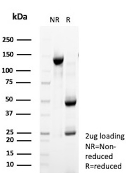 CLDN18 Antibody
