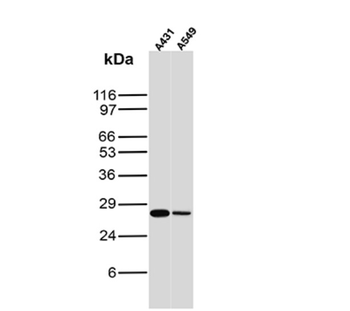 CLDN18 Antibody