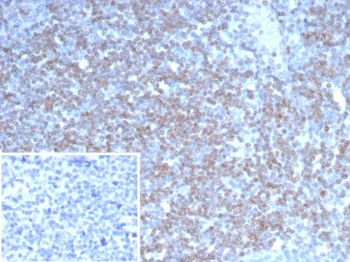 NEUROG3 Antibody