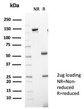 IL31 Antibody
