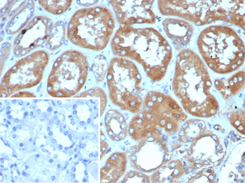 RHOBTB2 Antibody