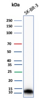 S100A16 Antibody