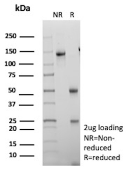 S100A16 Antibody