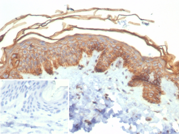 S100A16 Antibody