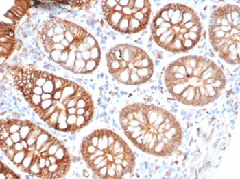 S100A16 Antibody