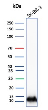 S100A16 Antibody
