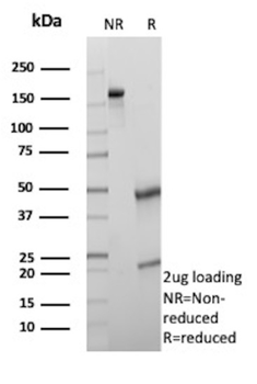 S100A16 Antibody