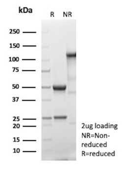 S100A16 Antibody