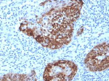 S100A2 Antibody