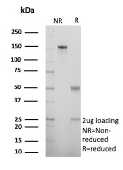 S100A2 Antibody