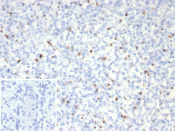 PRF1 Antibody