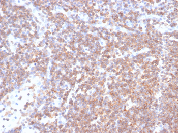 plk1 Antibody