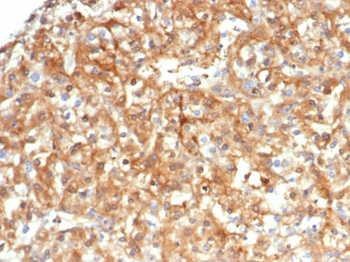 SERPINA1 Antibody