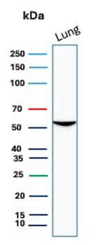 SERPINA1 Antibody