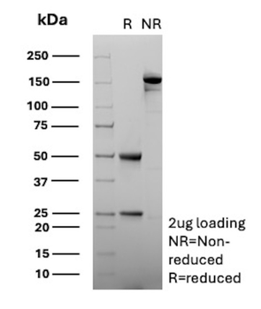 SERPINA1 Antibody