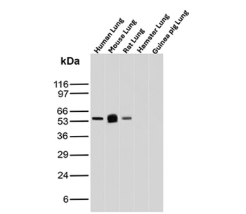 SERPINA1 Antibody