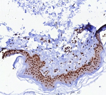 PCNA Antibody
