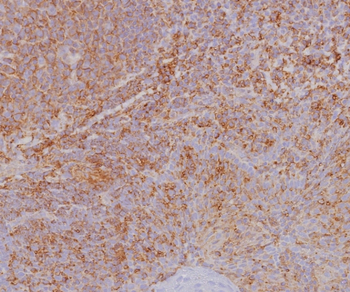 HLA-B Antibody