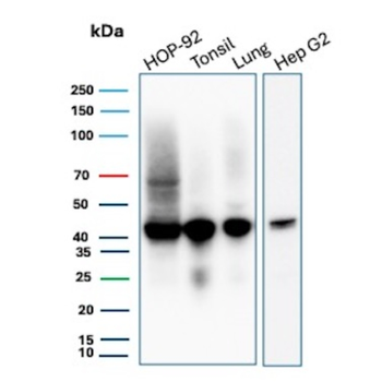 HLA-B Antibody