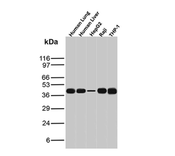 HLA-B Antibody
