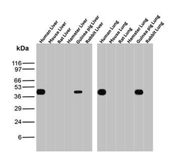 HLA-B Antibody