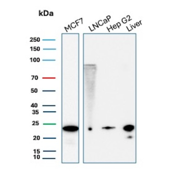 MGMT Antibody