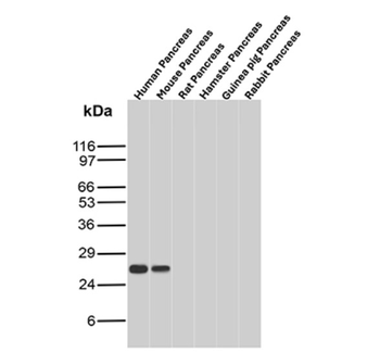 MGMT Antibody