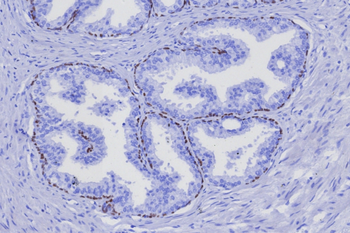 TP63 Antibody