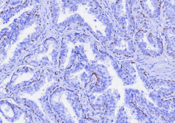 TP63 Antibody