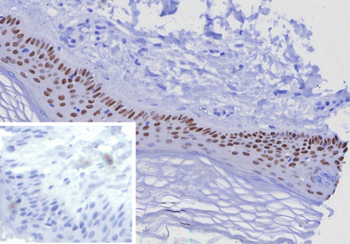 TP63 Antibody