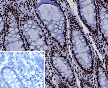 SMARCA4 Antibody
