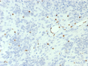 SMARCA4 Antibody