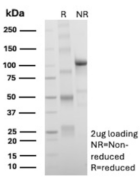 SMARCA4 Antibody