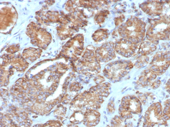 PTGS2 Antibody
