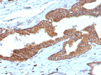 PTGS2 Antibody