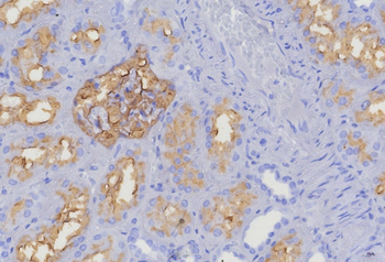 MME Antibody