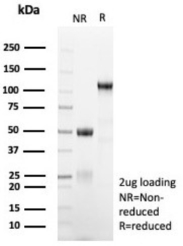 MGMT Antibody