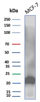 MGMT Antibody