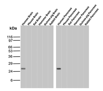 MGMT Antibody