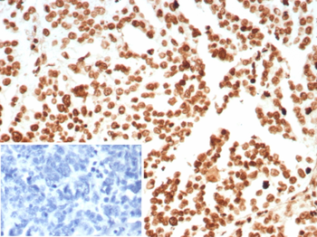 Recombinant Histone H1 (Pan Nuclear Marker) Antibody