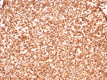 Recombinant Histone H1 (Pan Nuclear Marker) Antibody