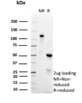Recombinant Histone H1 (Pan Nuclear Marker) Antibody
