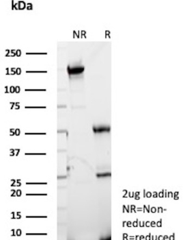 ENO2 Antibody