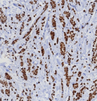 TRPS1 Antibody