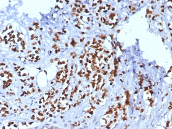 TRPS1 Antibody