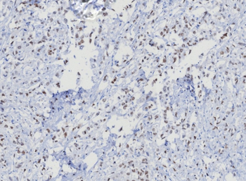 TRPS1 Antibody