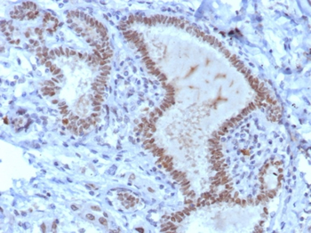 TRPS1 Antibody