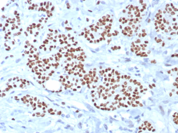 TRPS1 Antibody