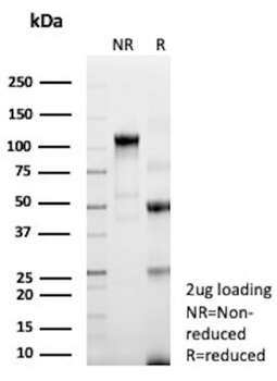 TRPS1 Antibody