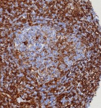STING1 Antibody